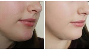 Shine and Glow Treatment is eradicating the dullne... main image