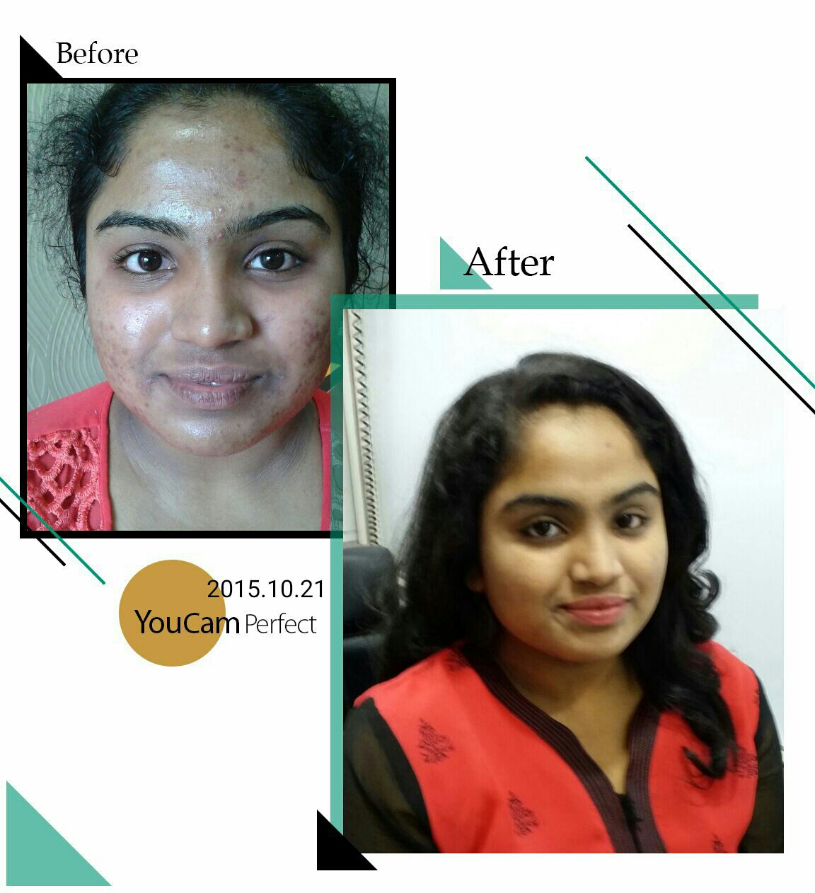                                           Acne Tre... main image