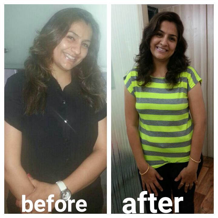 Weightloss Management P... main image
