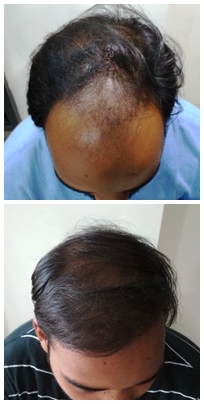 update image