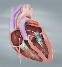 Get  Treatment for Cardiologist Doctor In PCMC,... main image