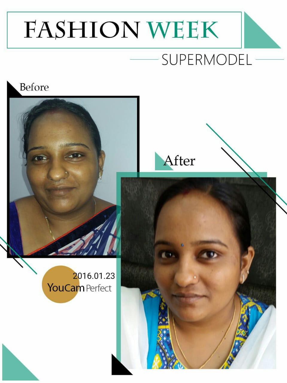 Skin Whitening & Brightening Treatment
Skin wh... main image