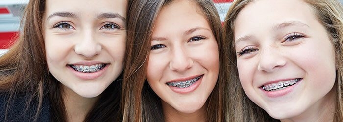 ORTHODONTIC /BRACES TREATMENT
Braces are device... main image