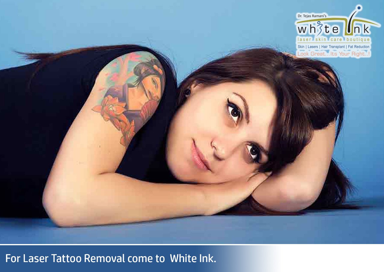 How Long Does Laser Tattoo Removal Take  Rejuvene MD