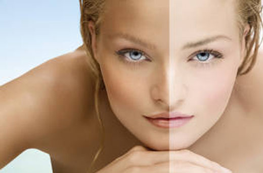 Skin Whitening Treatment
There are different m... main image