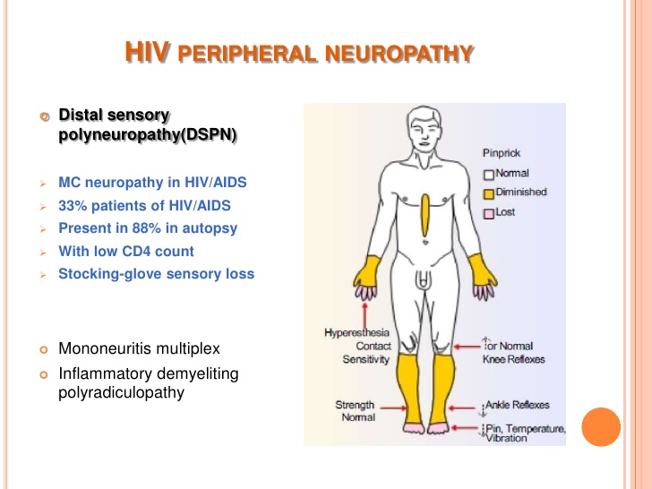 Nuropathic pain is c