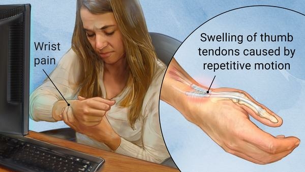 update image not found