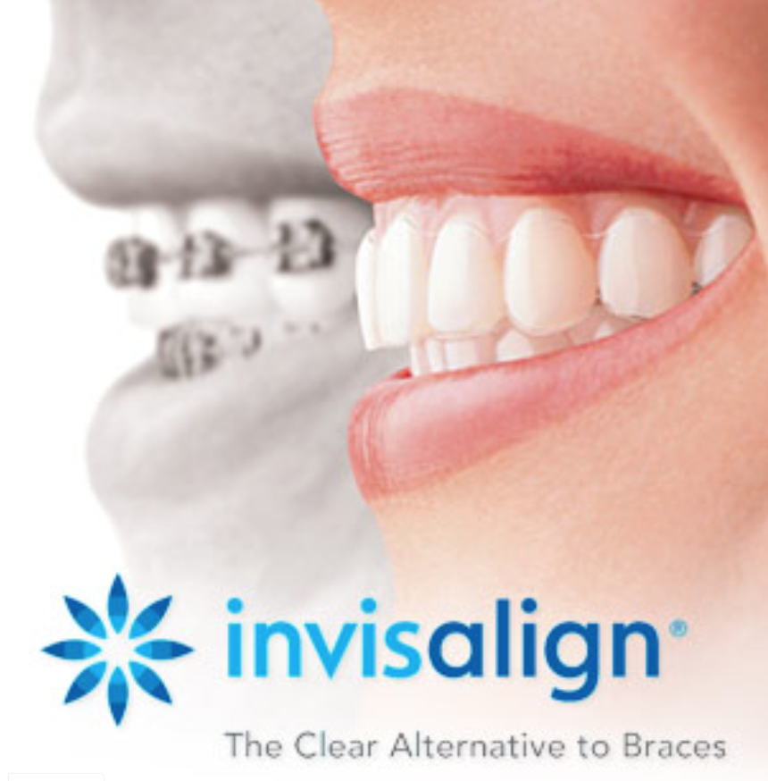 Many of our adult patients are unaware that there is an alternative to