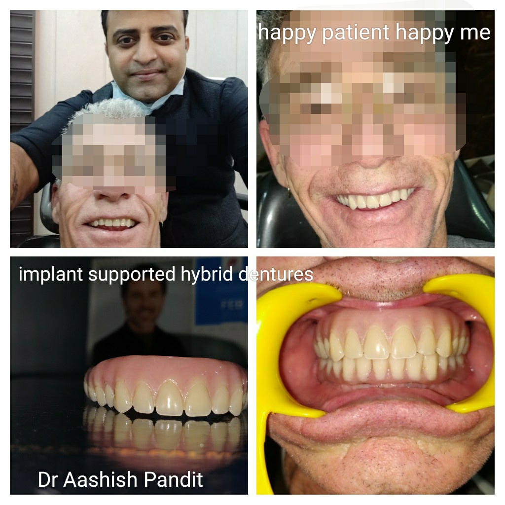 Dr Pandit dental clinic ,  Dr Aashish Pandit , Dr ... main image