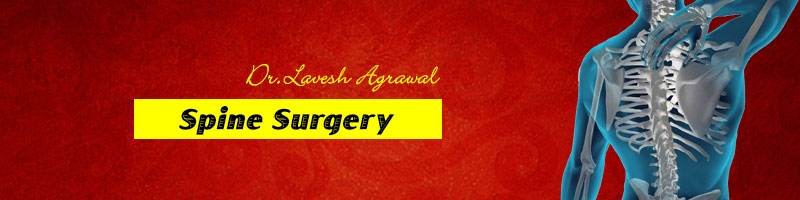 Spine surgery
Spine surgery is traditionally do... main image