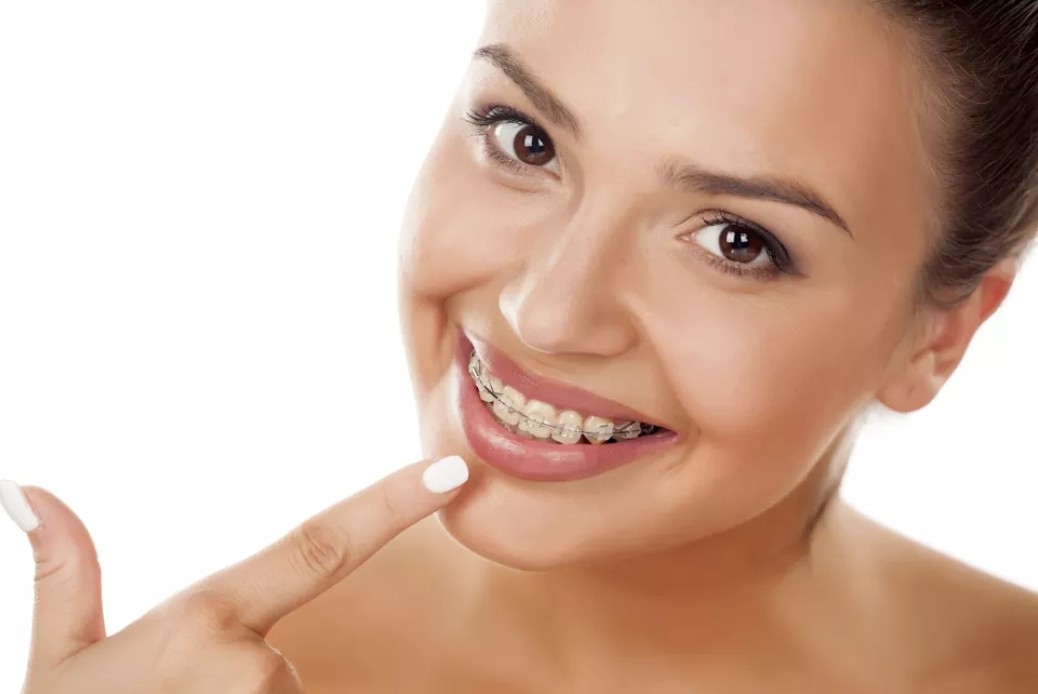 BRACES CAN CHANGE YOUR LIFE IN A POSITIVE MANNE... main image