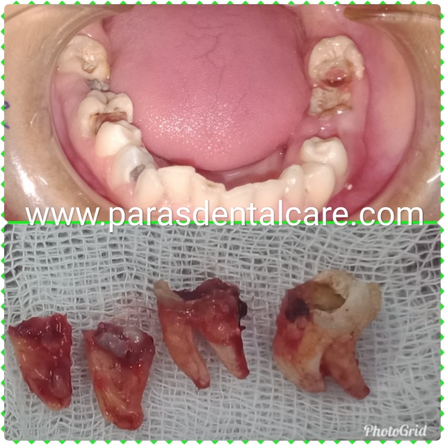 We at Paras Dental Care, Implant and Orthodontic c... main image