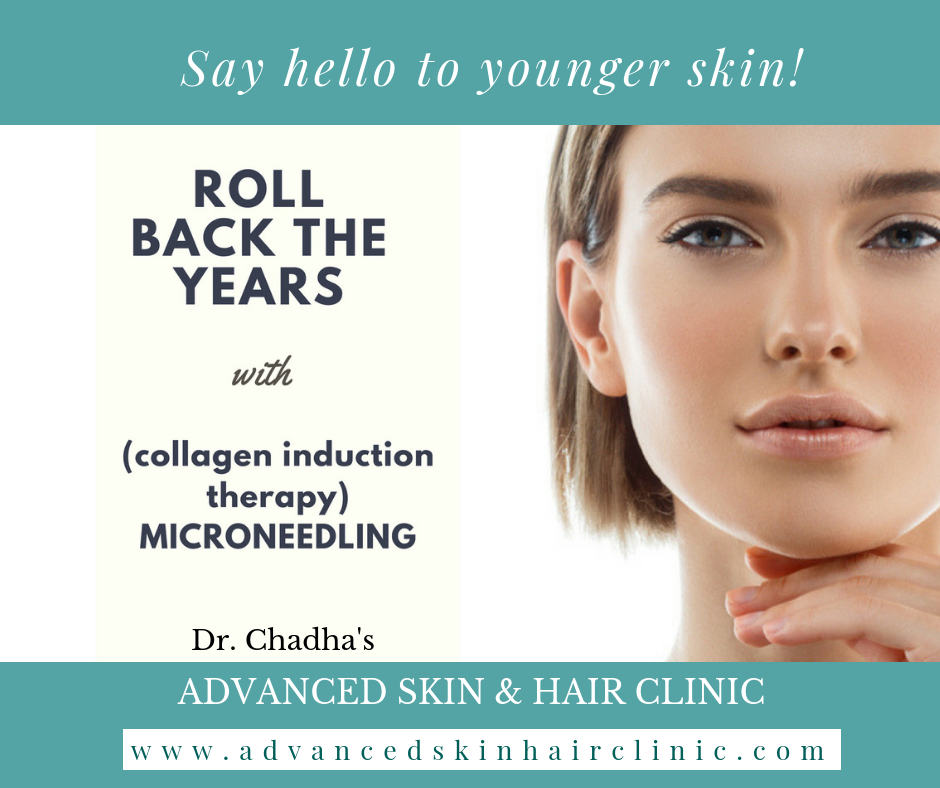 We Use Microneedling To Treat And Improve Conditions Like Acne Scarring Fine Lines And Wrinkles Loose Skin Skin Texture Pore Size Brown Spots Stretch Marks And Pigment Issues It S Also Called Skin
