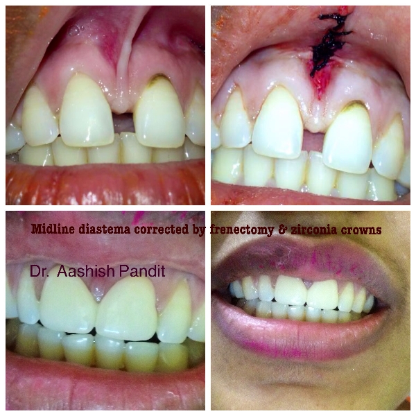 Established in 2013 Dr Pandit's dental clinic prov... main image