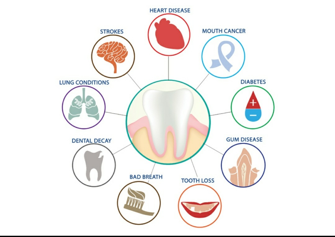 Studies confirm that periodontitis ( gum disease) ... main image