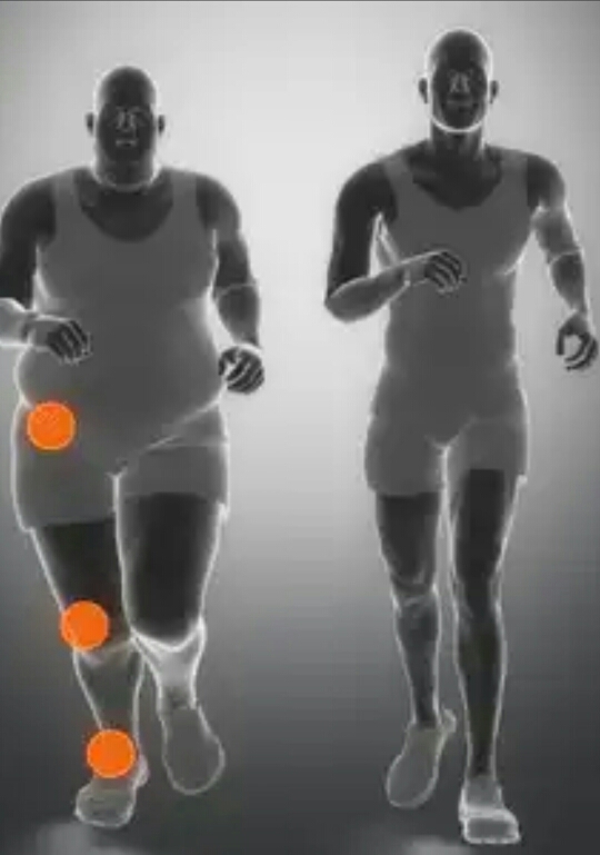 Over weight can leads to joint pains in hip and... main image