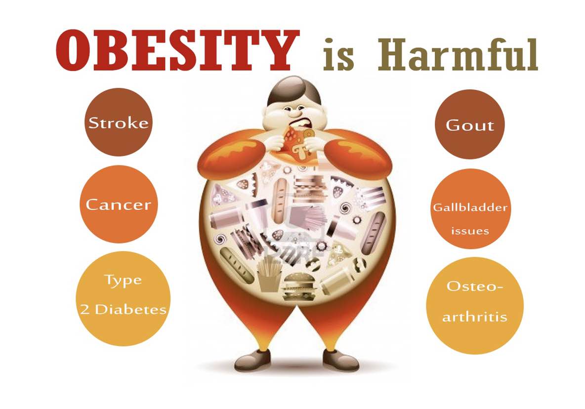 Best solution for obesity near me. Best solution for obesity in the