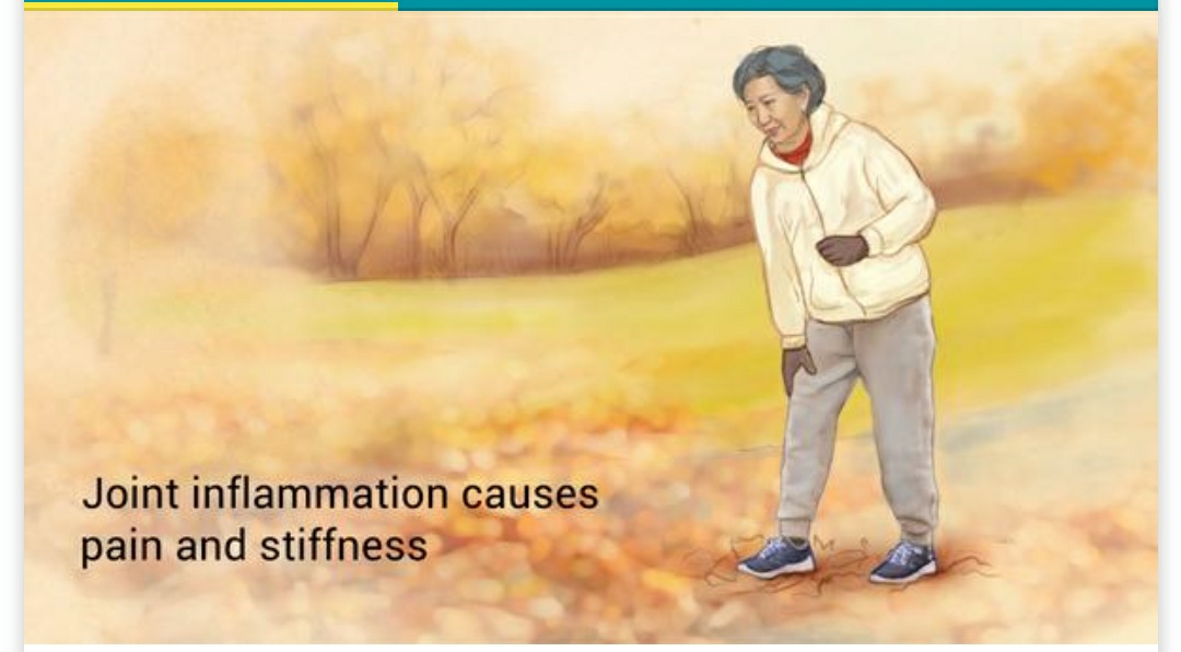Arthritis is a disorder that affects the joints... main image
