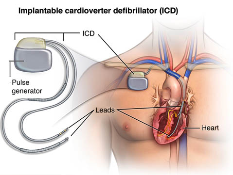 :Indian Heart Association Guidelines to primar... main image