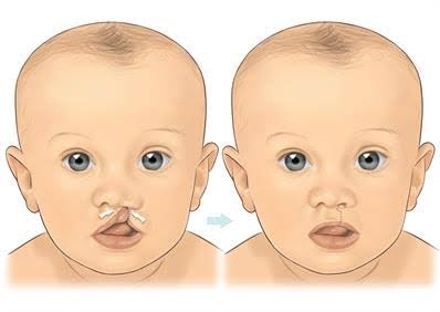 Liposuction
Rhinoplasty 
Implants 
Tummytuck 
Gyna... main image