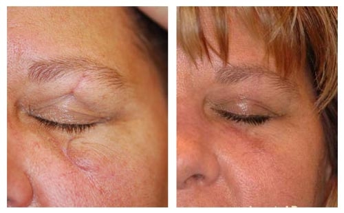 Liposuction
Rhinoplasty 
Implants 
Tummytuck 
Gyna... main image