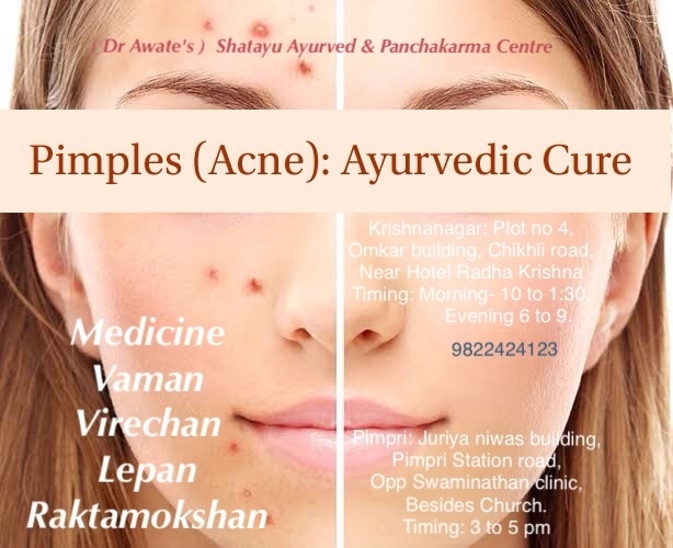 best ayurvedic medicine for acne