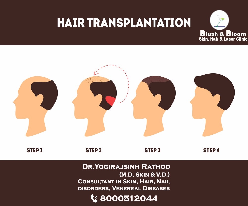 Liposuction
Rhinoplasty 
Implants 
Tummytuck 
Gyna... main image