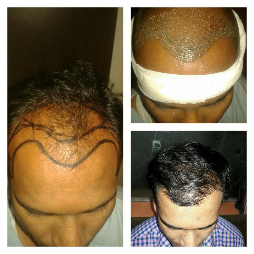 Get the crown back before it turns your identit... main image