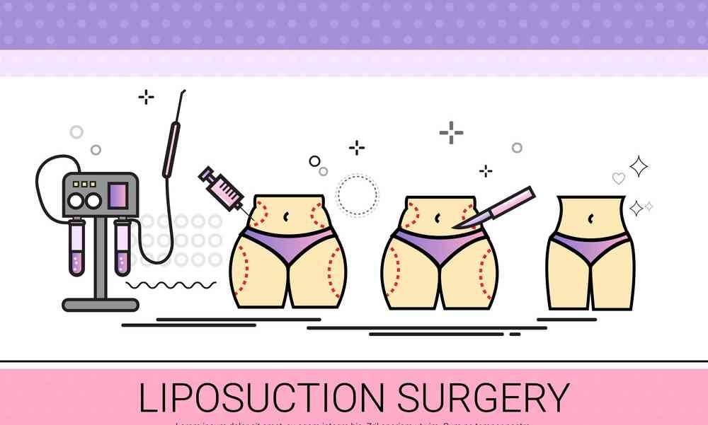 Liposuction
Rhinoplasty 
Implants 
Tummytuck 
Gyna... main image