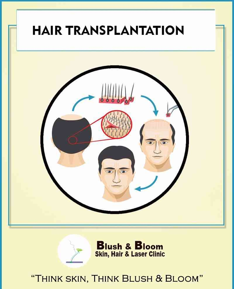 Liposuction
Rhinoplasty 
Implants 
Tummytuck 
Gyna... main image