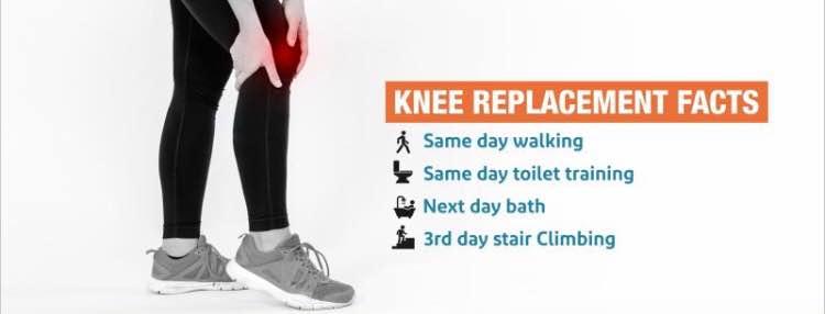 Here is the truth about Post Total Knee Replace... main image