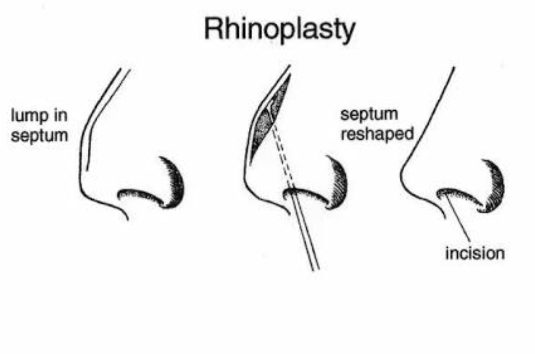 Liposuction
Rhinoplasty 
Implants 
Tummytuck 
Gyna... main image