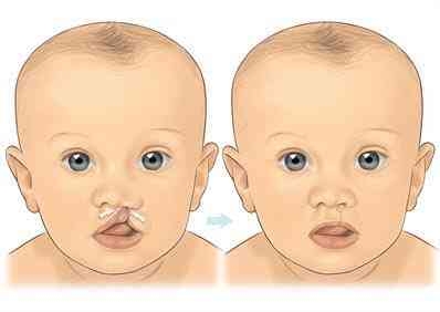 Liposuction
Rhinoplasty 
Implants 
Tummytuck 
Gyna... main image