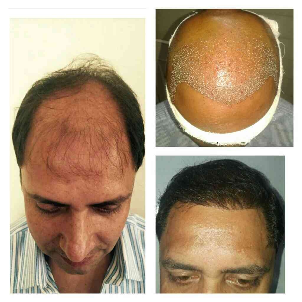Liposuction
Rhinoplasty 
Implants 
Tummytuck 
Gyna... main image
