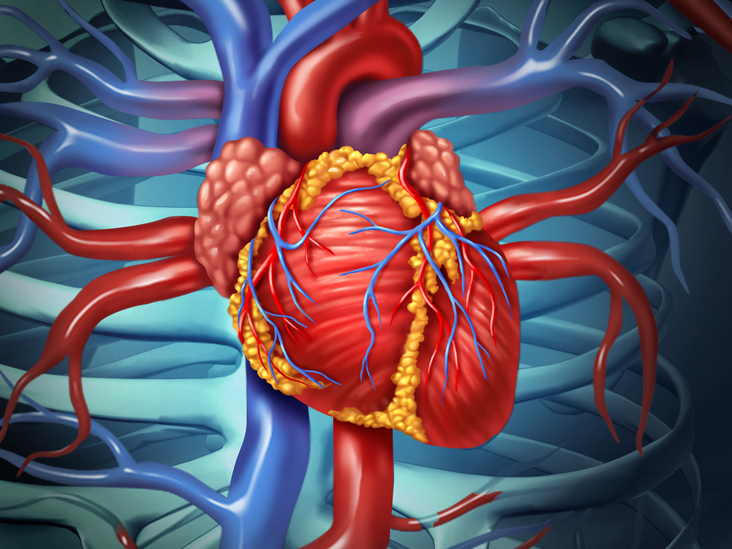 Searching For Heart Surgery Hospital in PCMC ? ... main image