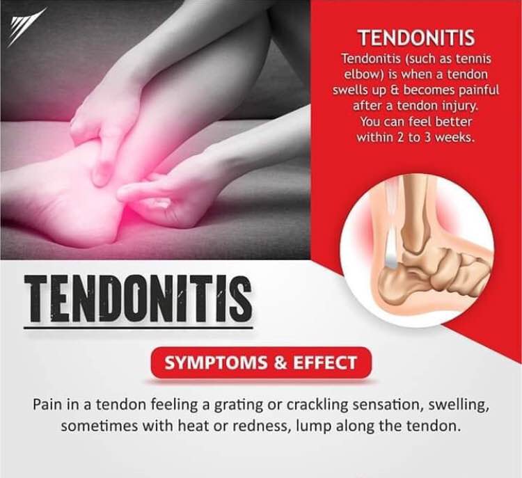 Joint pain main image