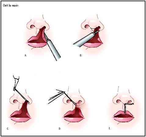 Liposuction
Rhinoplasty 
Implants 
Tummytuck 
Gyna... main image