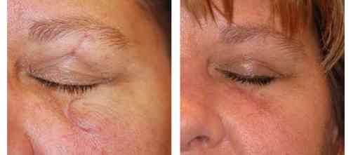 Liposuction 
Rhinoplasty 
Implants 
Tummytuck 
Gyn... main image