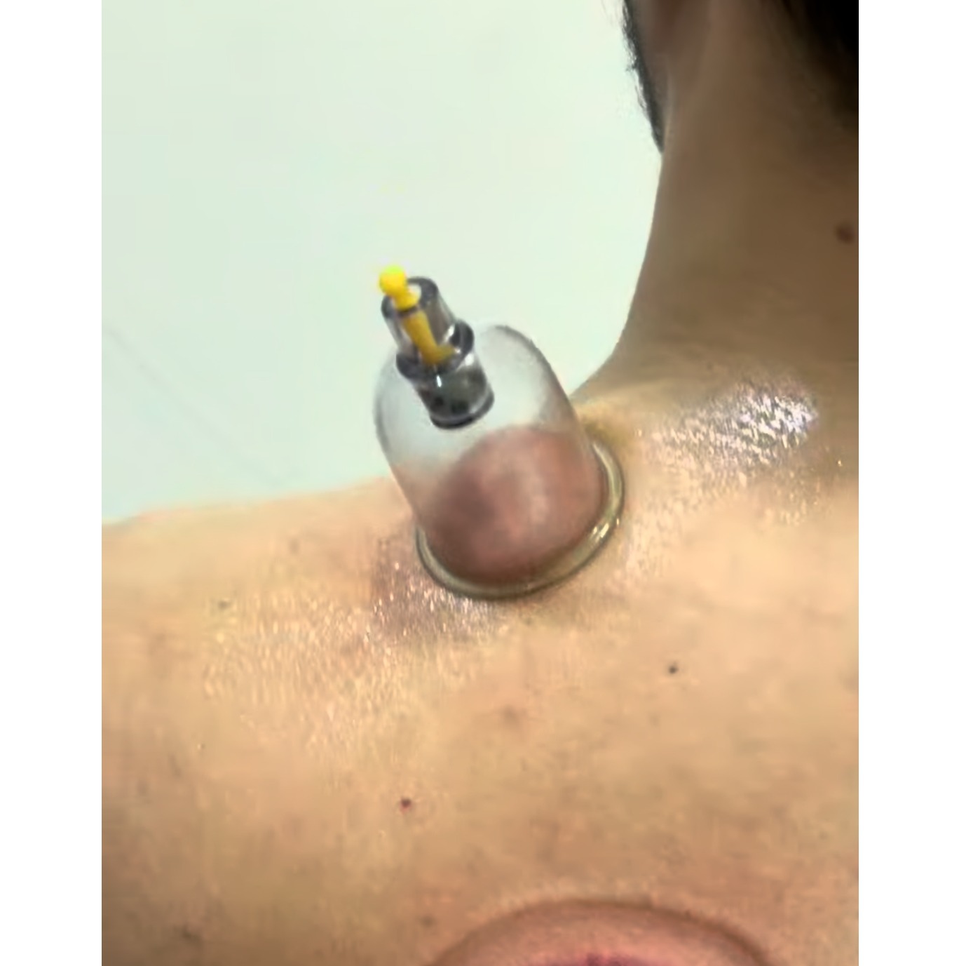 overhead athlete shoulder mana
