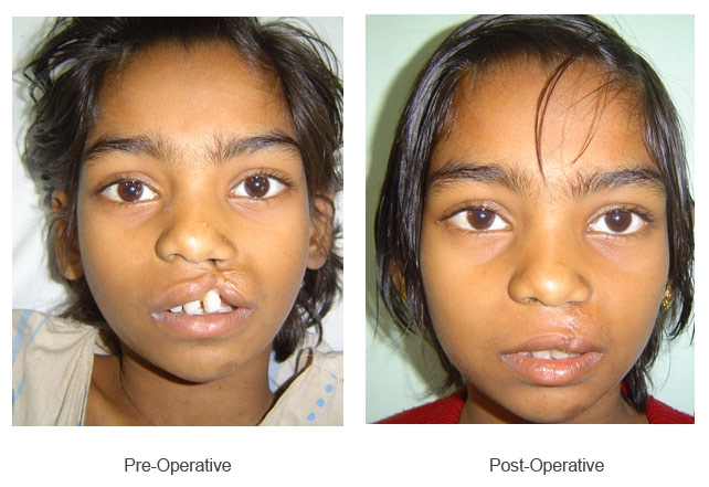 Liposuction 
Rhinoplasty 
Implants 
Tummytuck 
Gyn... main image