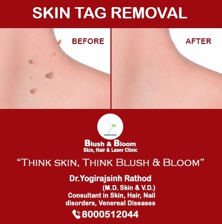 Think_Skin_Think_Blush_& _Bloom
skin_specialist_in... main image