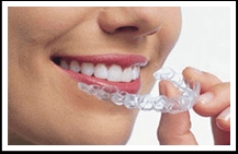 GET YOUR BEAUTIFUL SMILE FOR A LIFETIME WITH CLEAR... main image
