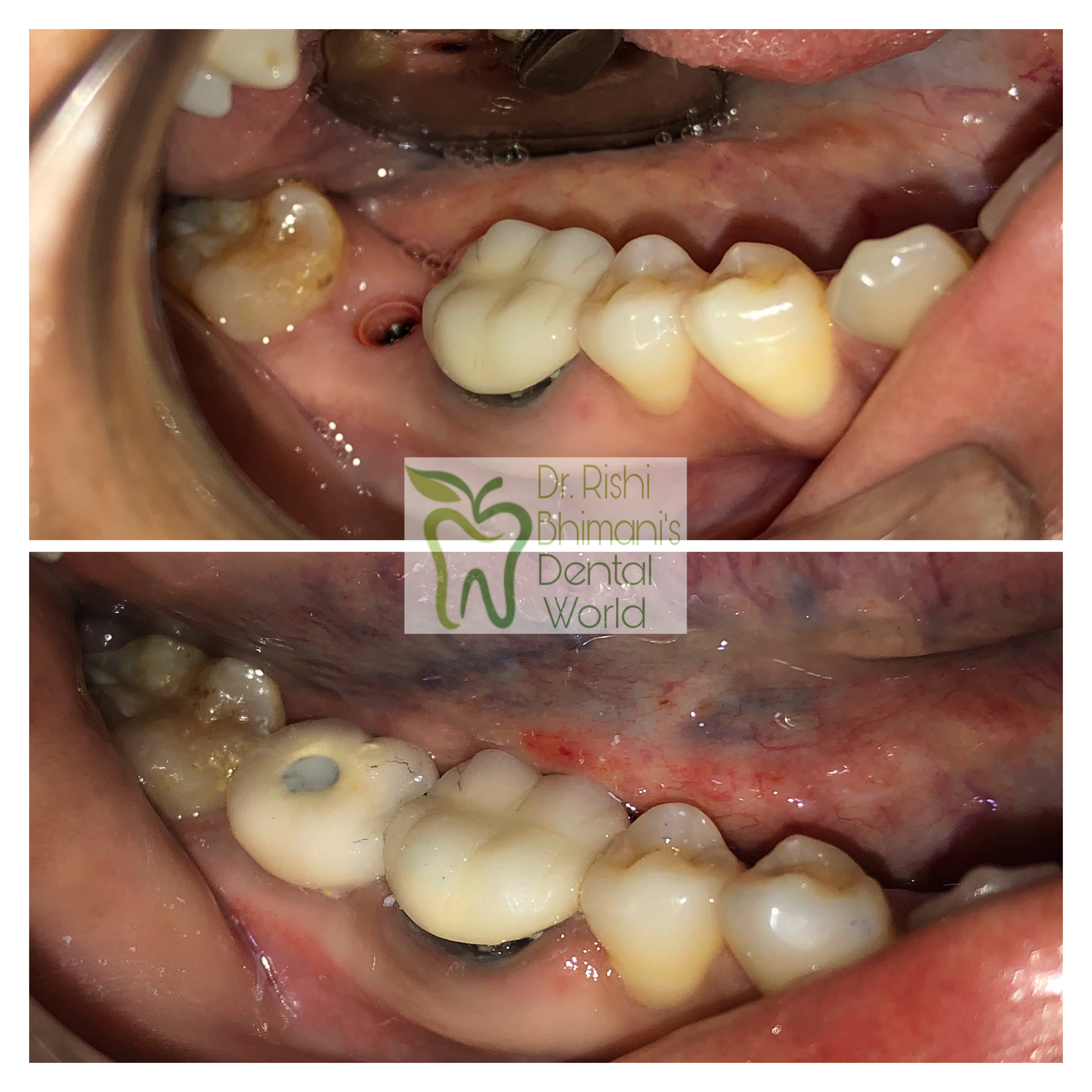 DENTAL IMPLANTS
DENTAL IMPLANTS can be used to ... main image