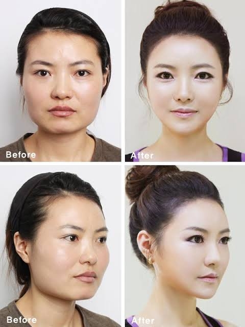 Liposuction 
Rhinoplasty 
Implants 
Tummytuck 
Gyn... main image