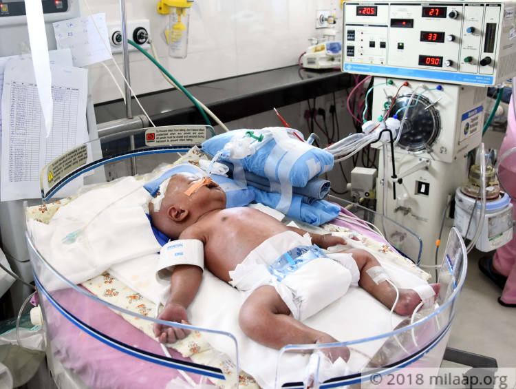 child hospital in nagpur
child hospital in nandanv... main image