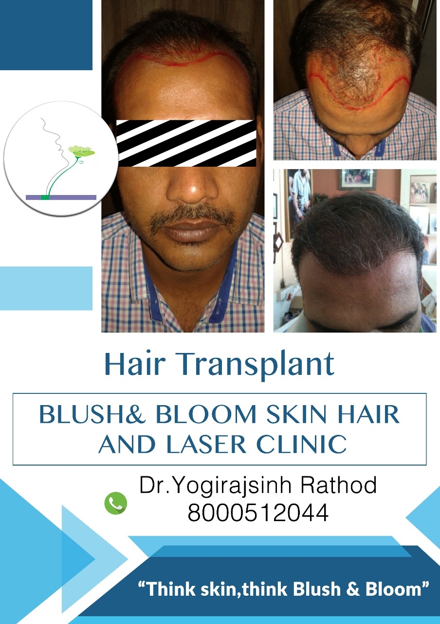 Think_Skin_Think_Blush_& _Bloom
skin_specialist_in... main image