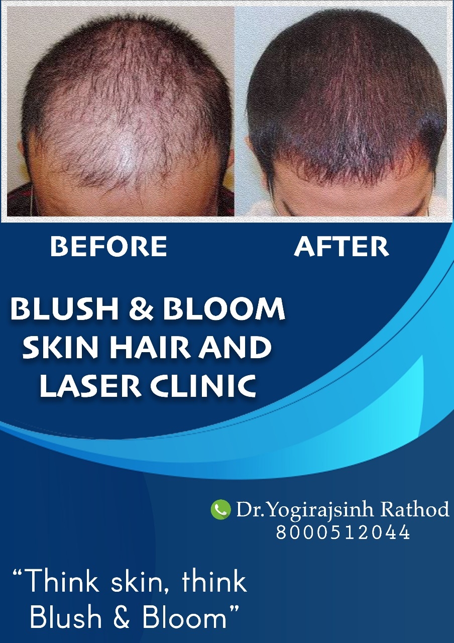 Think_Skin_Think_Blush_& _Bloom
skin_specialist_in... main image