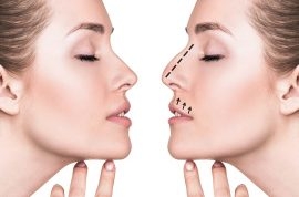 Liposuction 
Rhinoplasty 
Implants 
Tummytuck 
Gyn... main image
