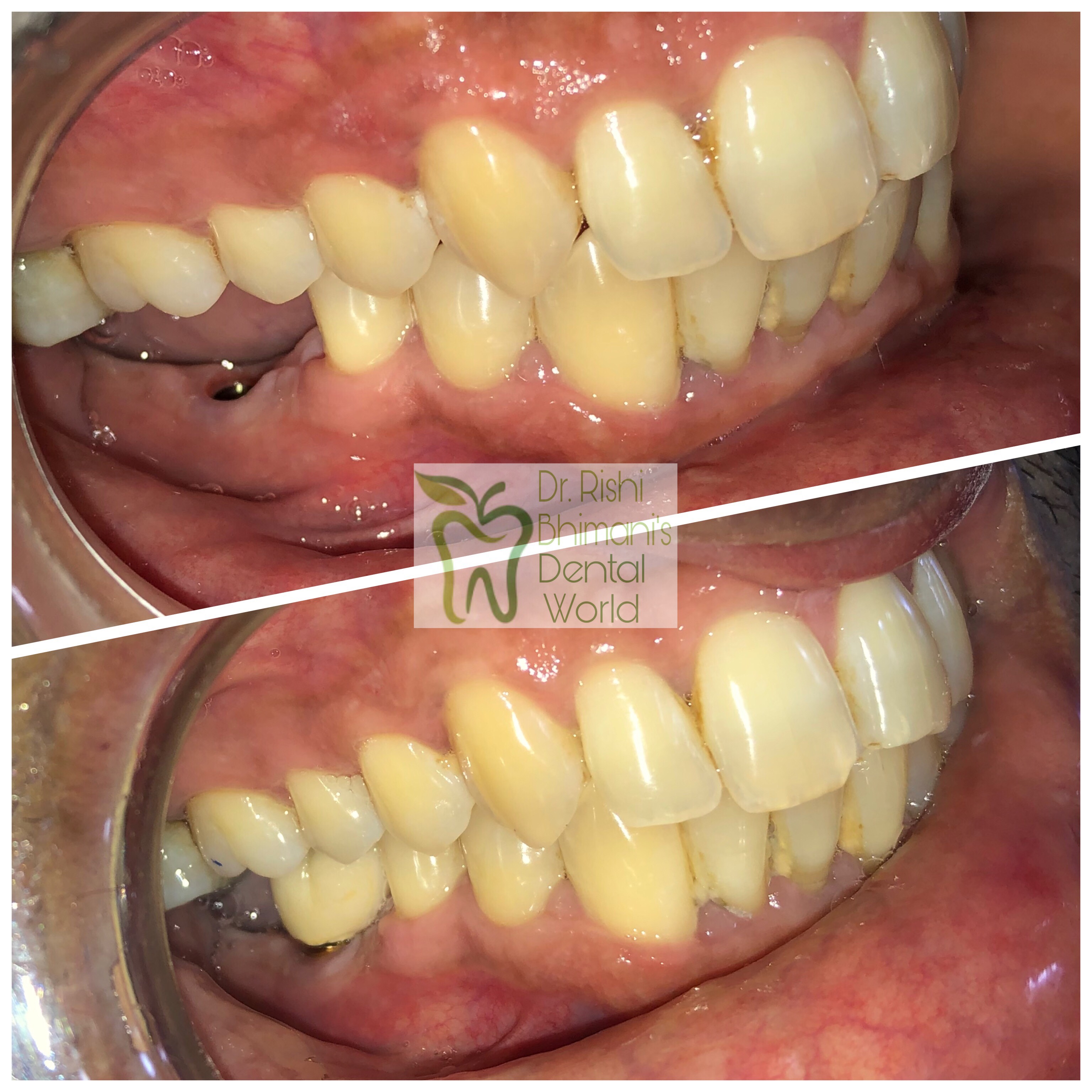 DENTAL IMPLANTS IN NAVI MUMBAI
DENTAL IMPLANTS ... main image