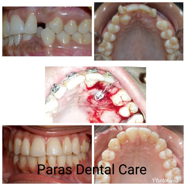 Orthodontic Case 

A female patient age 19 year... main image